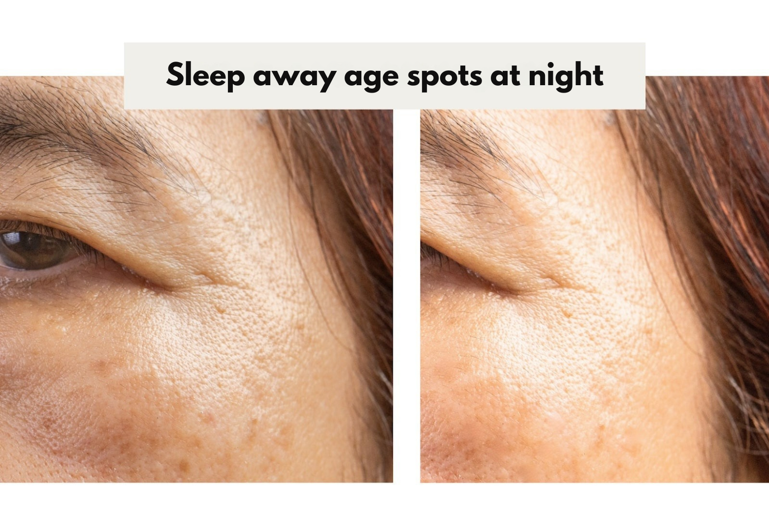 Sleep away age spots