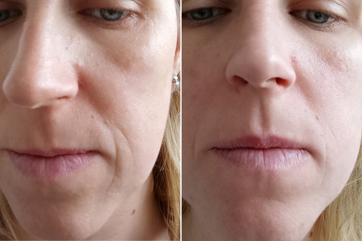 Customer result