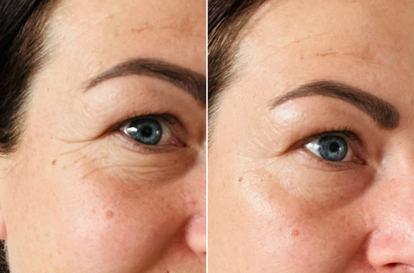 Customer result