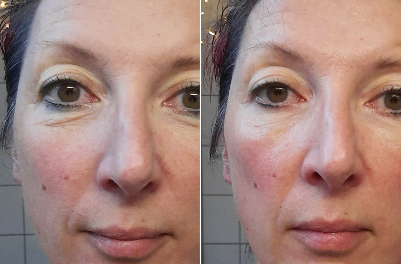 Customer result