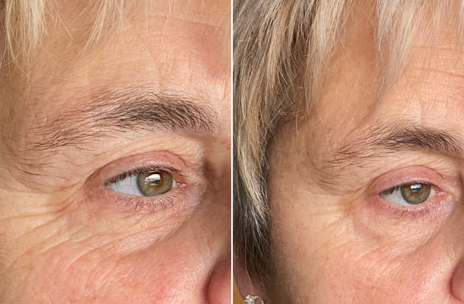 Customer result