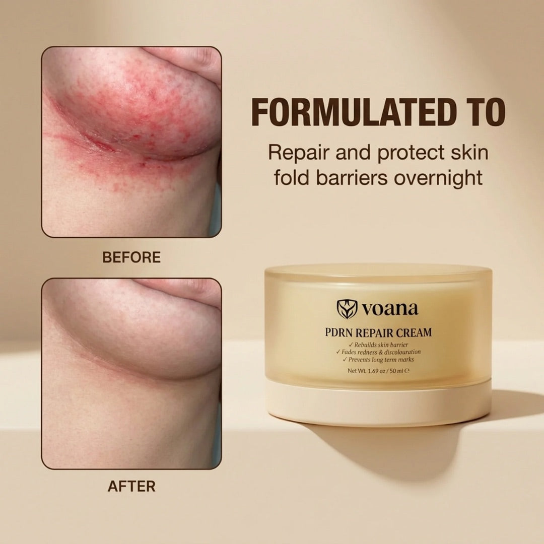 VOANA PDRN Repair Cream formulated to repair and protect skin fold barriers overnight