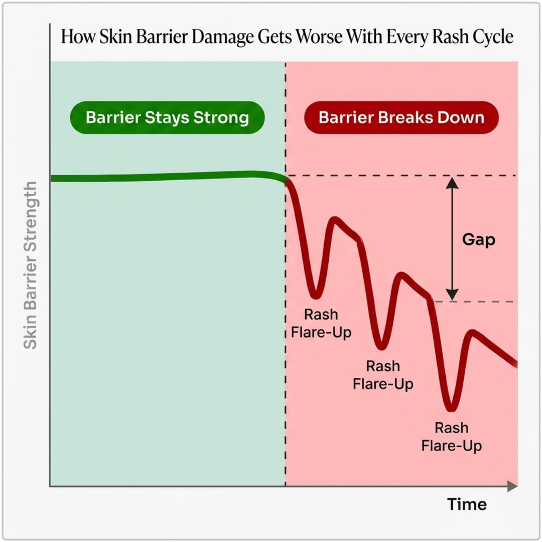 How skin barrier damage gets worse with every rash cycle